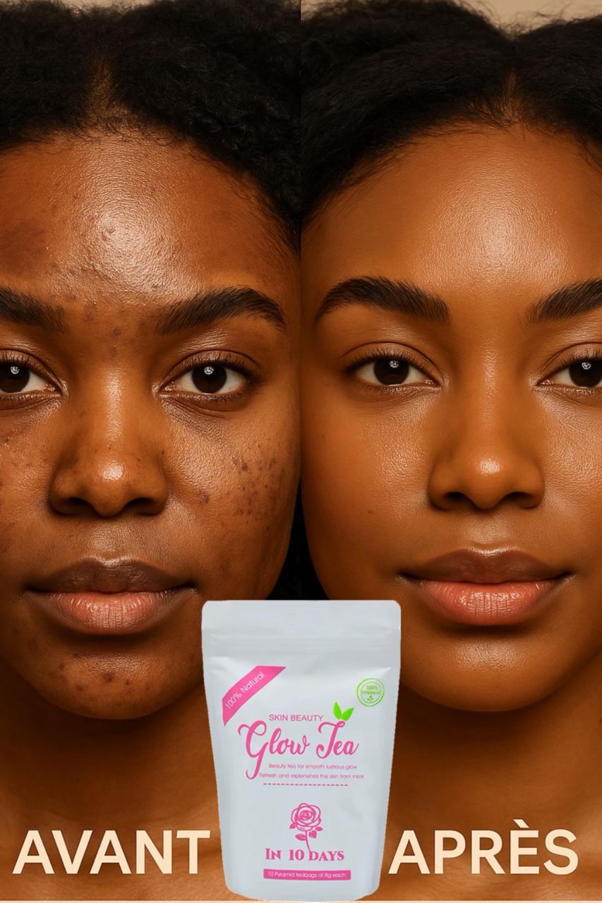 Glow Tea – La Beauté de la Peau Commence de l’Intérieur